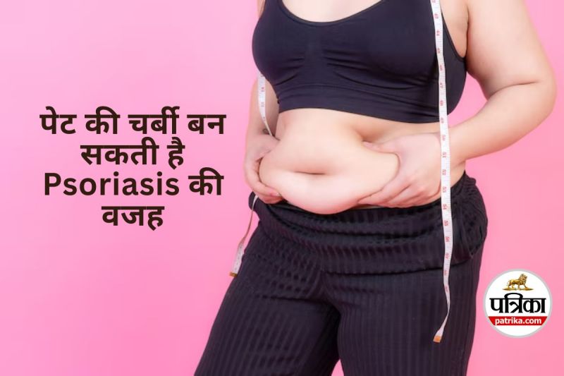 Belly Fat Could Trigger Psoriasis
