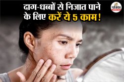 Home Remedies for itching in Monsoon: मानसून में खुजली, रैशेज और दाग-धब्बों से
परेशान है तो ये 5 घरेलू उपाय दिलाएंगे राहत - image