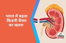 Kidney Cancer Crisis : भारत दुनिया के टॉप चार देशों में, किडनी कैंसर के शुरुआती
लक्षण - image