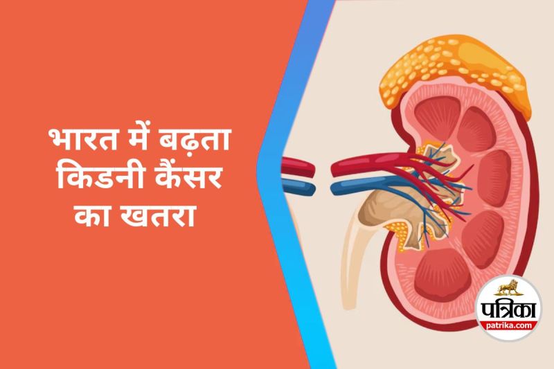 Kidney Cancer Crisis