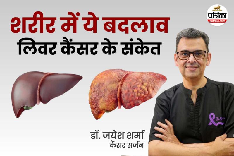 Liver Cancer Symptoms, Liver Cancer Signs, Tests For Liver Cancer, Cancer Surgeon,