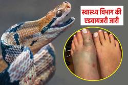घबराहट में तेजी से फैलता है ‘सांप का जहर’, बचने के लिए करें ये 4 काम - image
