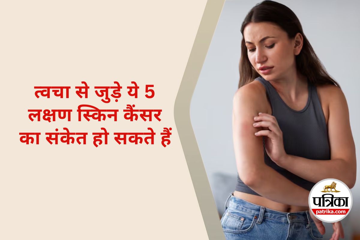 Skin Cancer : त्वचा का कैंसर या साधारण दाग? ये 5 चेतावनी संकेत नजरअंदाज न करें
