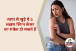 Skin Cancer Symptoms