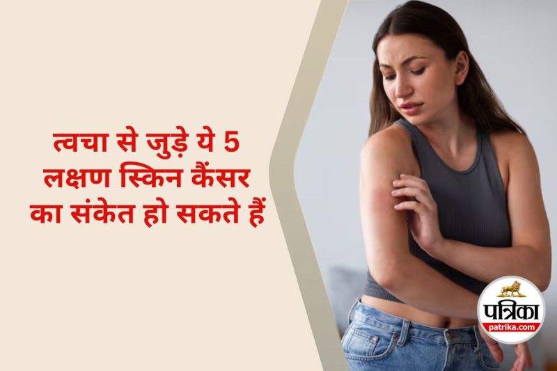 Skin Cancer Symptoms