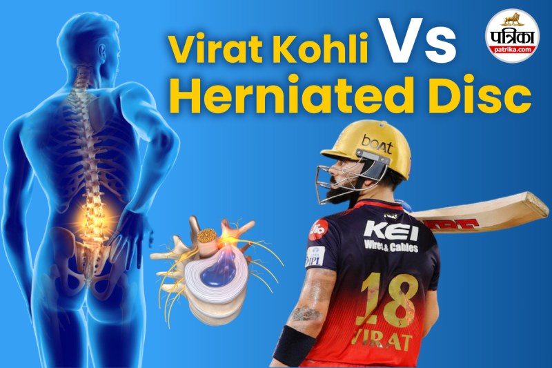 Virat Kohli Herniated Disc
