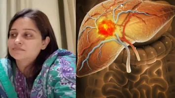 Dipika Kakar liver tumour surgery