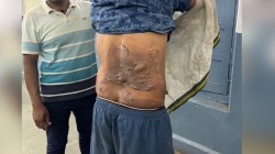 राजस्थान: पत्नी ने पति पर खौलता तेल और पानी डाला, फिर किया कमरे में बंद, गंभीर
रूप से झुलसा - image