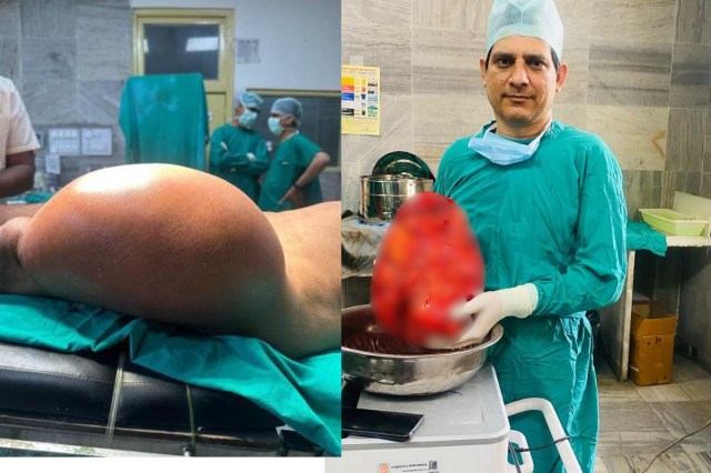 operation