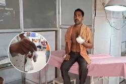 अपनी उंगली काटकर अस्पताल लेकर पहुंचा युवक, वजह कर देगी हैरान - image