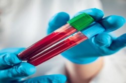 New Cancer Test : नया ब्लड टेस्ट शुरुआती चरणों में करेगा जानलेवा कैंसर की पहचान - image