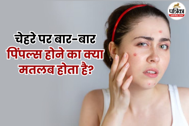 Causes of pimples on face