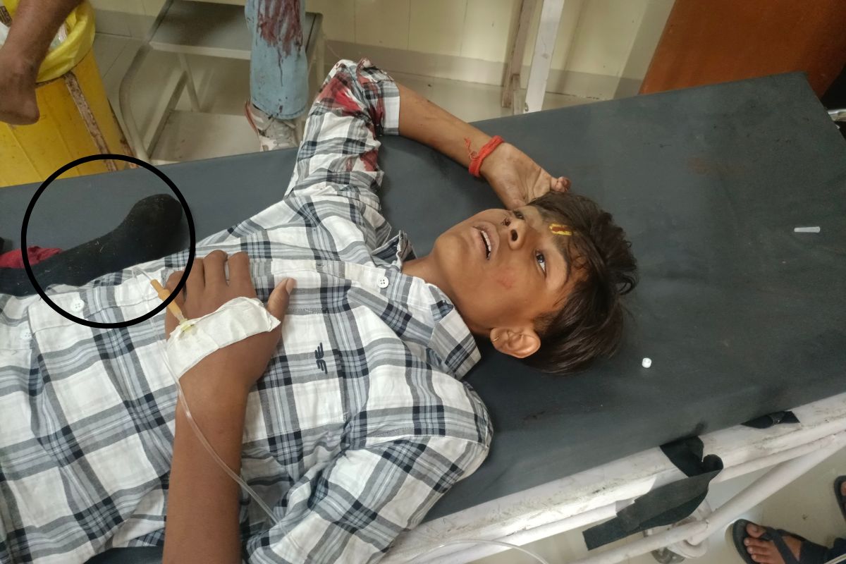 Sikar Accident: हादसे में बाइक सवार का कटा पैर, खाटूश्यामजी से लौट रहा था, शादी
में आया था उदयपुरवाटी