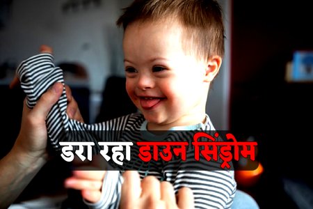 Down Syndrome Disease