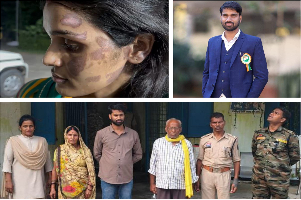 Cruelty: क्रूरता की हद! पत्नी को बेरहमी से पीटा, चेहरा गर्म पानी में डूबाया, फिर
चिमटी से दागा पूरा शरीर, पति, सास-ससुर गिरफ्तार