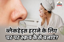 Blackhead Remover Mask: बिना पार्लर जाए, इन 3 आसान घरेलू उपायों से हटाएं
ब्लैकहेड्स - image
