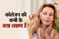 Collagen Deficiency Symptoms: अगर शरीर में दिखें ये 7 संकेत, तो हो सकती है
कोलेजन की कमी - image