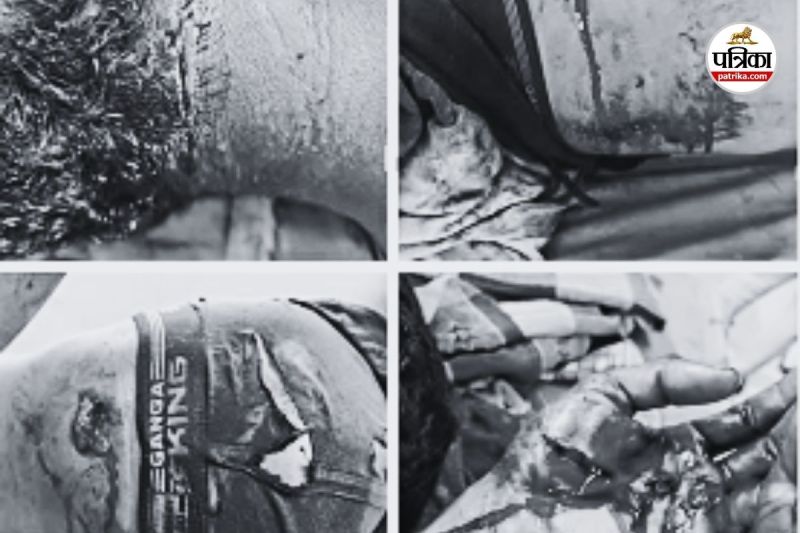 3 भालुओं ने किया हमला (Photo source- Patrika)