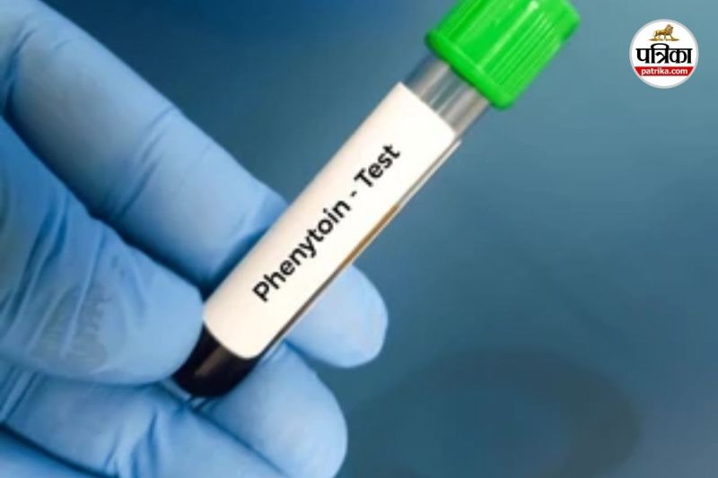 इंजेक्शन फेनीटोन सोडियम बैन (Photo source-shutterstock)