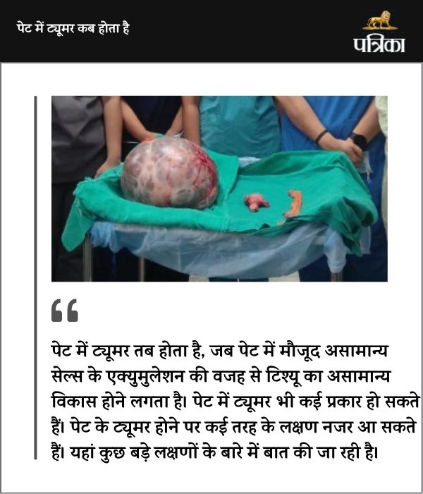 महिला के पेट से निकाला 10 किलो का ट्यूमर (फोटो सोर्स- पत्रिका)