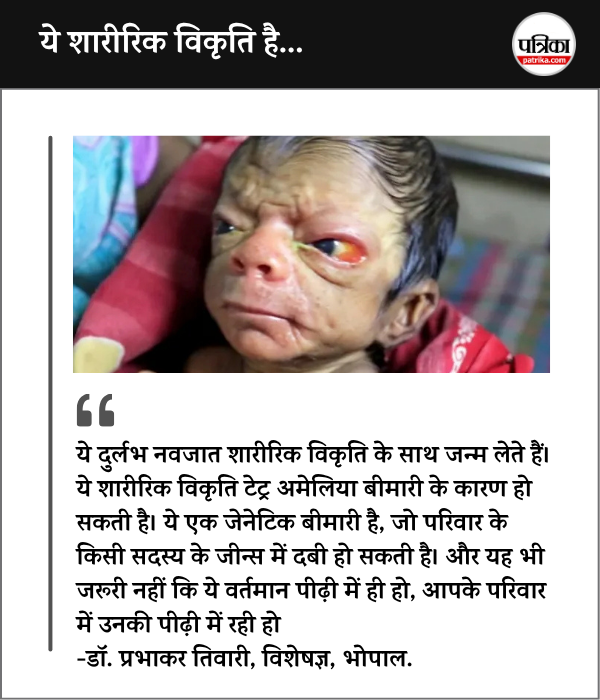 Rarest Newborn Baby in MP