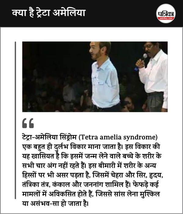 Tetra amelia syndrome