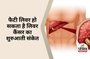Fatty Liver Can Invite Cancer