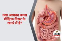 Gastric Cancer