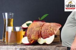 Apple Cider Vinegar for Liver: फैटी लिवर में फायदेमंद है एप्पल साइडर विनेगर,
जानिए कैसे करें सेवन - image