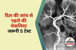 Angiography से पहले जरूरी 5 टेस्ट - image