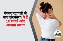 Itchy Skin Causes : शरीर की खुजली है किसी बड़ी बीमारी का संकेत? जानिए 10 छिपे
हुए कारण और राहत पाने के उपाय - image