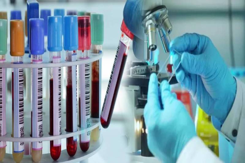 (फोटो सोर्स: सोशल मीडिया)