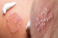 फोटो सोर्स: पत्रिका