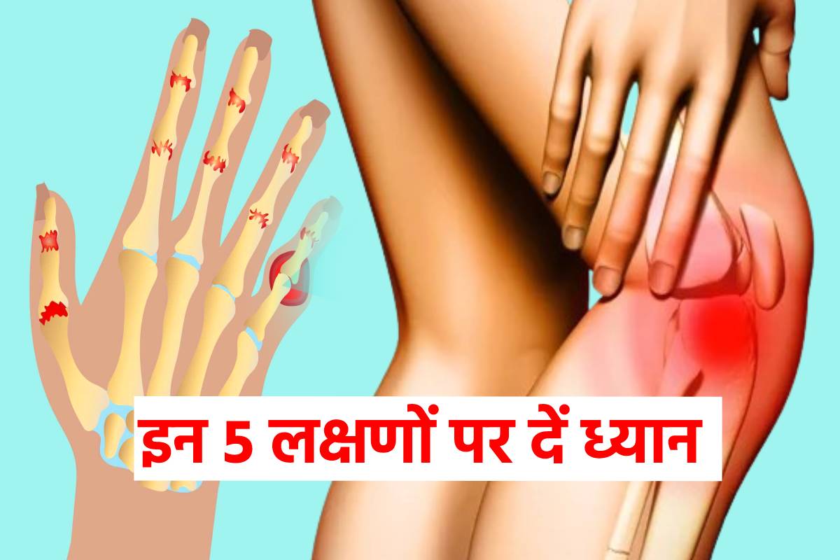 फोटो सोर्स: पत्रिका