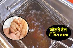 ‘खौलते तेल’ की टंकी में गिरा ढाई साल का मासूम, बिलखकर रोया पूरा गांव - image