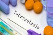 TB patients in Rajasthan