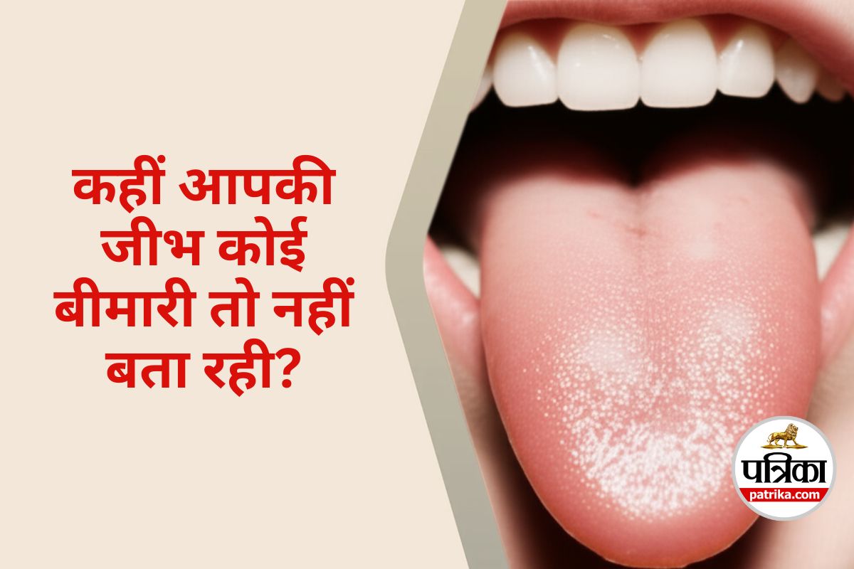Tongue Color Health Meaning
