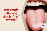 Tongue Color Health Meaning