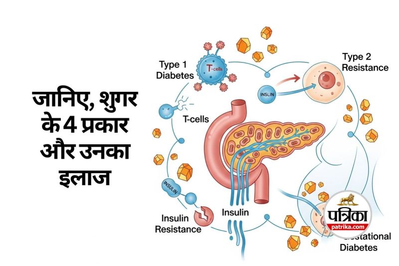 Types of Diabetes