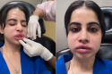 Urfi Javed's Face Severely Swollen; Difficult to Recognise