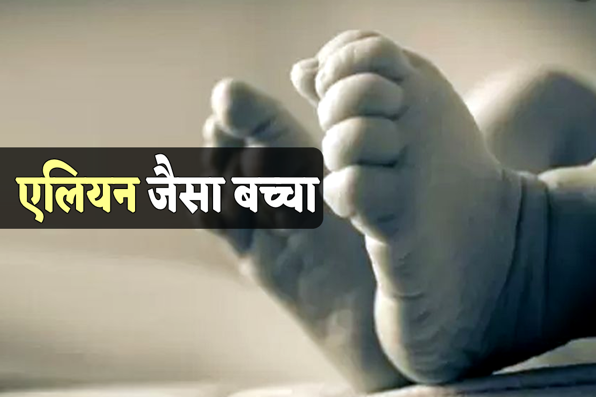 अजब-गजब एमपी में जन्मा हूबहू एलियन जैसा बच्चा, डॉक्टर्स को चौंकाया, किया रेफर