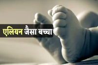 Newborn baby looking like alien was born in MP Rewa
