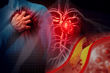 Cardiovascular Disease