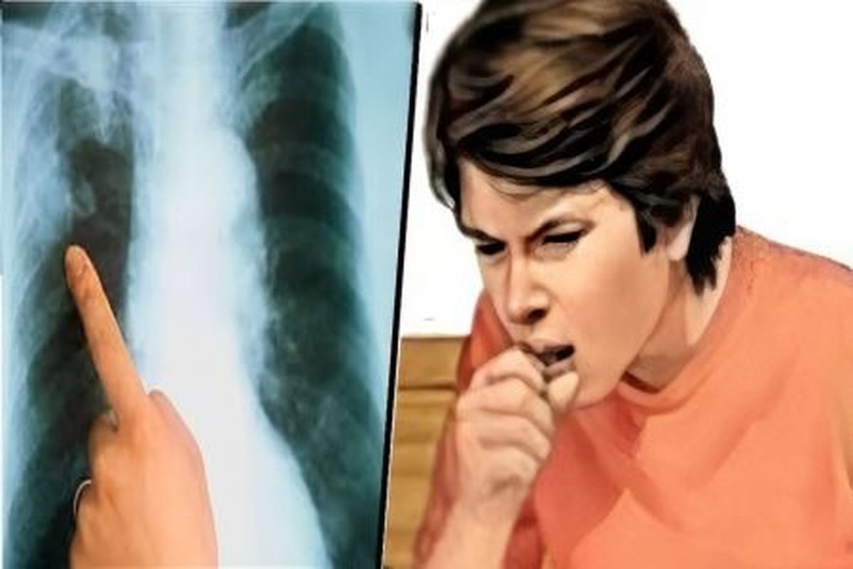 अलवर जिले में 115 ग्राम पंचायतें टीबी मुक्त घोषित