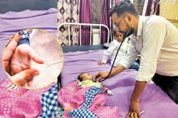 जयपुर में बच्चों को घेर रहा नया वायरस, सबसे अधिक प्रभावित 5 साल तक के बच्चे; हर
रोज 4-5 नए केस - image