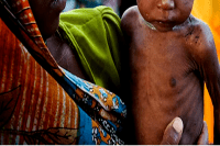 Malnutrition Wreaks Havoc