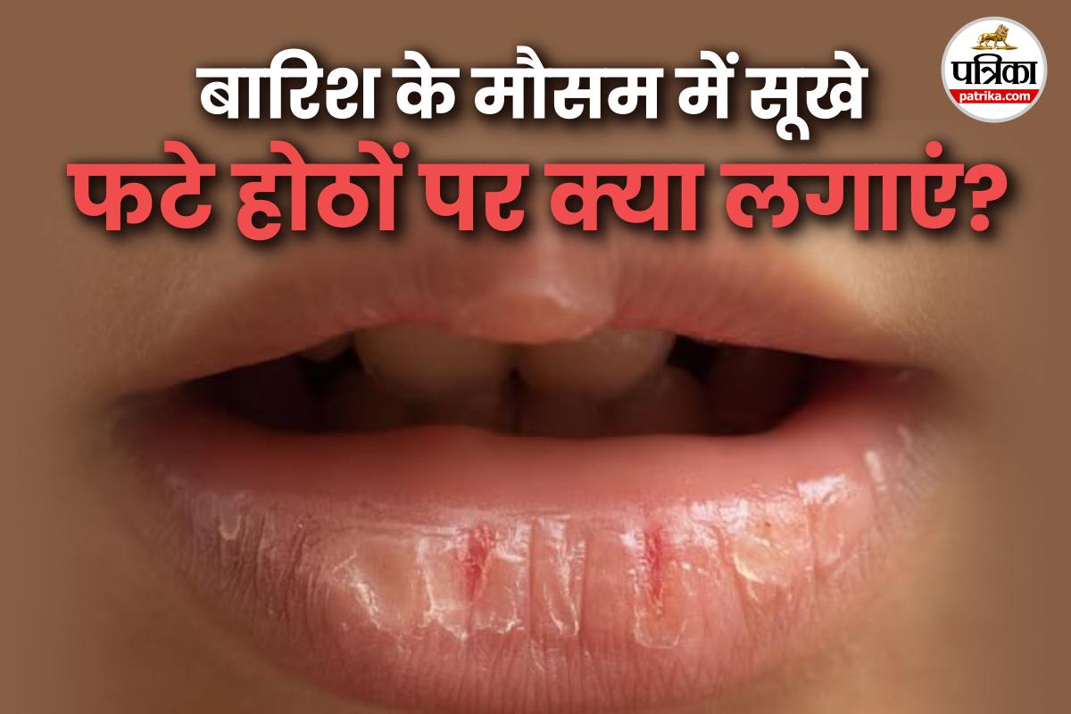 Dry Lips: बारिश में होंठों की देखभाल के लिए 5 असरदार घरेलू उपाय