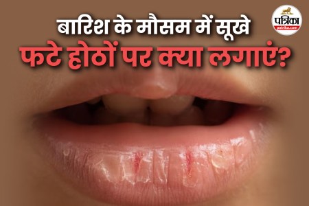 How to prevent dry lips in monsoon फोटो सोर्स – Freepik