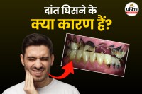 Teeth wearing down in Hindi, Teeth wearing down symptoms,