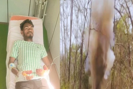 बीजापुर में IED ब्लास्ट की चपेट में आया ग्रामीण (Photo source- Patrika)